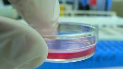 Convierten células cancerígenas en glóbulos blancos