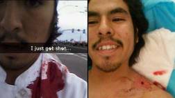 Snapchat: comparte 'selfie' luego de ser baleado
