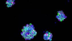 Crean dispositivo que ataca el tumor cerebral más agresivo