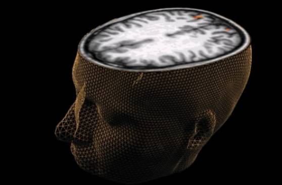 La deficiencia de vitamina E puede dañar el cerebro