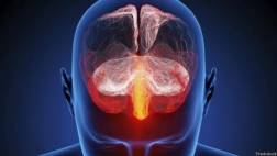 Chips en el cerebro permitirán escribir con la mente