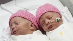 Mellizas en Nueva Jersey tienen padres distintos