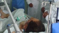 Tía María: realizarán reconstrucción de rostro a policía herido