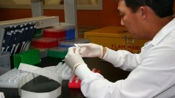 Identifican una mutación asociada al riesgo de aneurisma