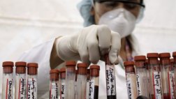Prueban un tratamiento contra el VIH más barato y simple