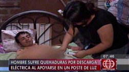 Rímac: sufrió quemaduras de tercer grado por tocar caja de luz