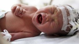 Crean software que evalúa el nivel de dolor en los niños