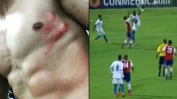 Nelson Valdez quedó así tras recibir una brutal patada (VIDEO)