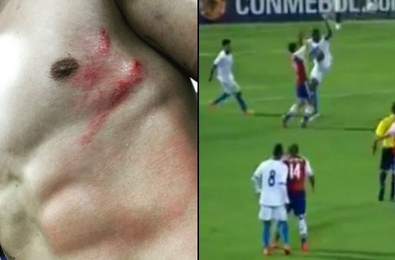 Nelson Valdez quedó así tras recibir una brutal patada (VIDEO)