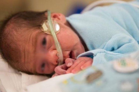 Este pequeño nació de una mujer con muerte cerebral en EE.UU.