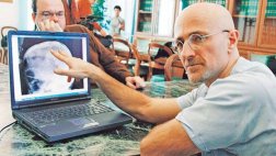 El cirujano de trasplante de cabeza pide ayuda a Bill Gates