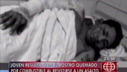 Carabayllo: ladrón prendió fuego a joven que se resistió a robo