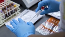 La polémica por los estudios experimentales en seres humanos