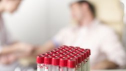 Para OPS homosexualidad no debe ser criterio para donar sangre