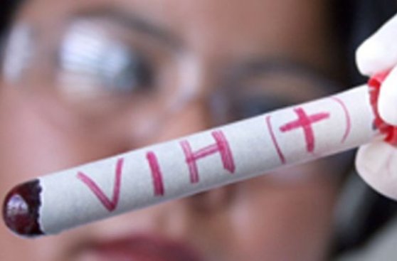 Adolescente con VIH consigue vivir sin señales de la enfermedad