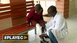 Uganda: la tecnología 3D ofrece a amputados una nueva vida