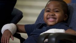 Niño de ocho años recibe un trasplante de manos