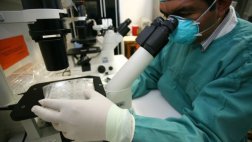Probarán en Haití un nuevo método para detectar tuberculosis