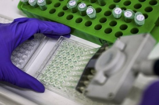 Nueva prueba detectaría cáncer de páncreas de manera temprana