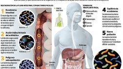 ¿Sabes que un trasplante fecal te puede devolver la salud?