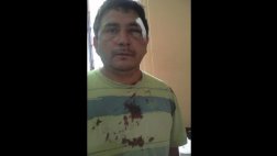 Áncash: adolescentes atacaron a pedradas a policía