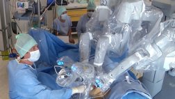 Usan robot para extraer y trasplantar riñón por la vagina