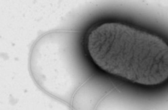 El polvo contiene un promedio de 9.000 especies de microbios