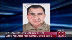 Los Olivos: conductor atropelló a policía frente a comisaría