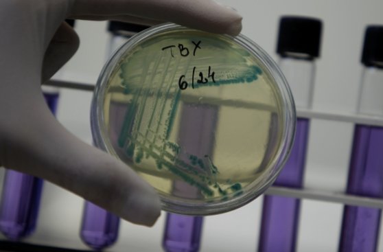 Proponen método para reducir bacteria 'E.coli' en alimentos