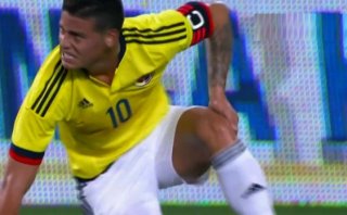James Rodríguez: mira la jugada de su lesión ante Perú (VIDEO)