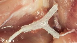 Dispositivo impreso en 3D ayuda a regenerar nervios dañados