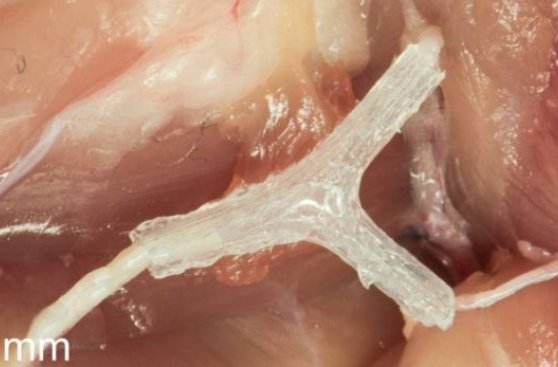 Dispositivo impreso en 3D ayuda a regenerar nervios dañados
