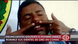 Comas: lo golpean para intentar robarle sus dientes de oro