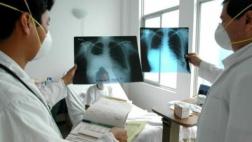 Muertes por tuberculosis se redujeron a la mitad en América