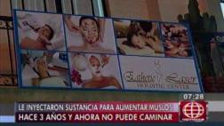 Lince: sufrió daños en las piernas por tratamiento de cosmiatra