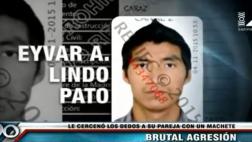 Santa Anita: sedó a su pareja y le cortó los dedos de la mano