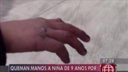 Detienen a pareja que quemó manos de niña de 9 años por castigo