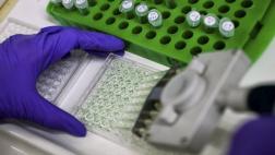 Médicos diseñan nueva prueba para detectar tumores cerebrales