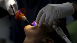 Crean dientes en 3D que pueden combatir la placa bacteriana