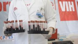 ONU espera poner fin a la epidemia del VIH para el 2030