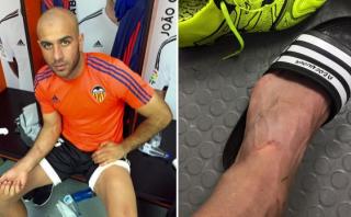 Luis Suárez le dejó estas heridas a jugador del Valencia