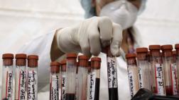 Crean un biofármaco que ayudará en tratamiento de la hemofilia