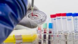 Hallan molécula que elimina proteína que causaría Alzheimer