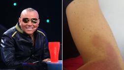 Carlos Cacho luce moretones tras agresión de Zumba