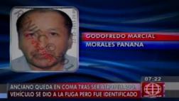 Sujeto que atropelló sin brevete a anciano sin orden de captura