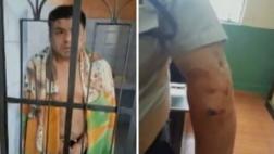 Mordió brazo de policía para evitar intervención en SMP