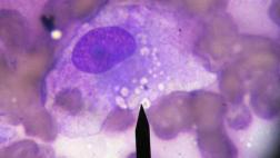 Bacterias de la Antártida podrían ayudar a rastrear el cáncer