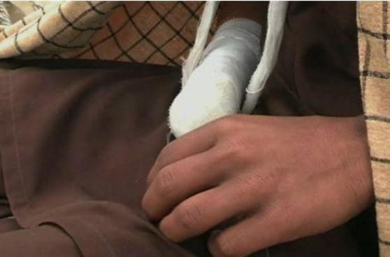 Pakistán: el niño que se cortó la mano por "insultar" a Mahoma