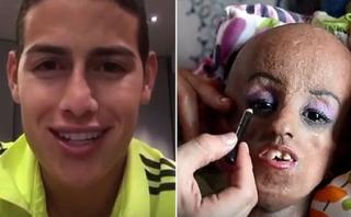 Magali, la joven que conmovió el corazón de James Rodríguez