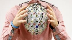 Actividad cerebral humana está vinculada a la forma cerebral